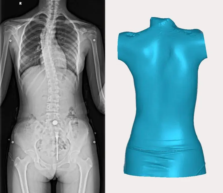 人體三維掃描儀